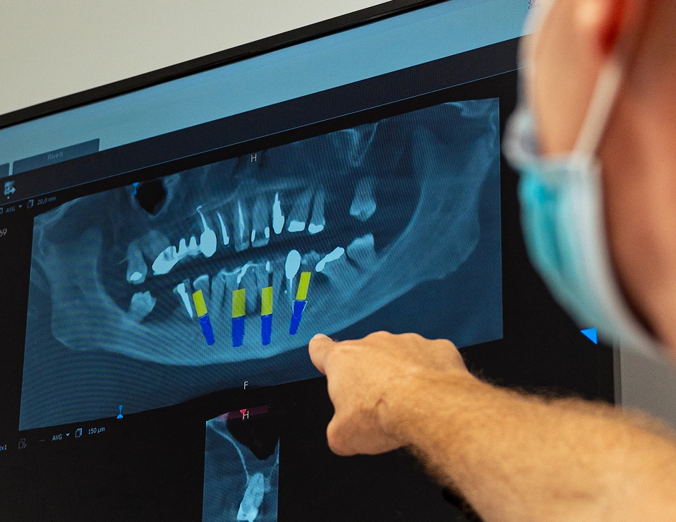 immagine radiografia